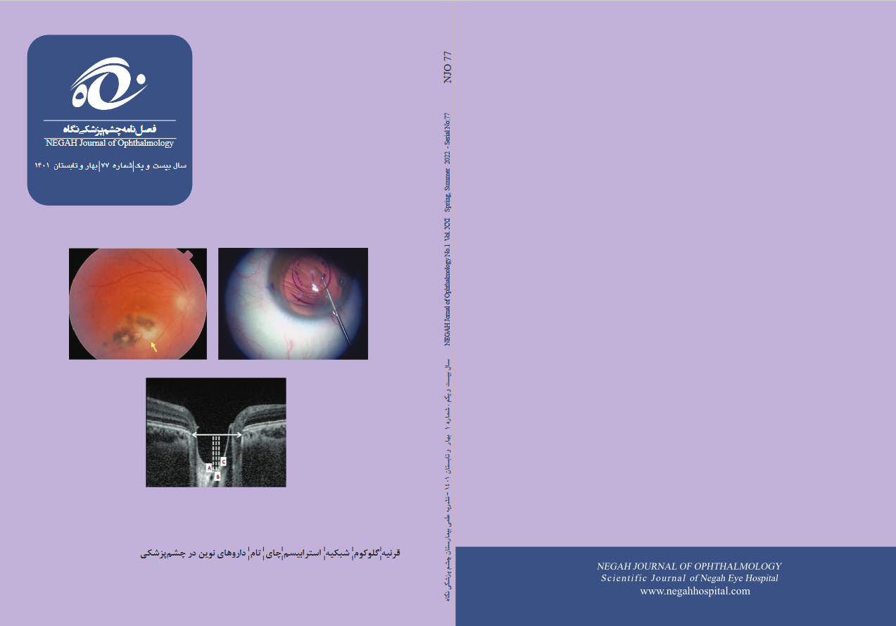 فصلنامه چشم پزشکی نگاه شماره ۷۷