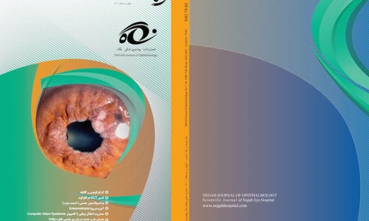 فصلنامه چشم پزشکی نگاه شماره ۷۹ – ۸۰